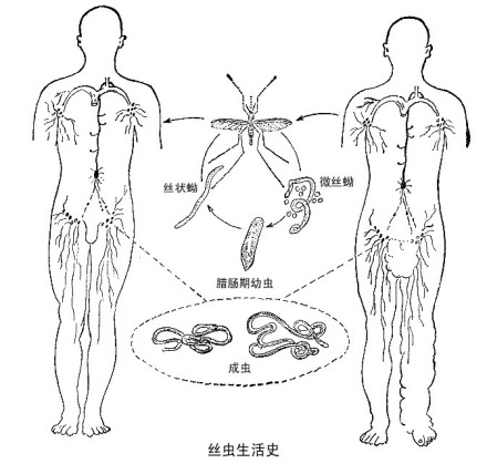 丝虫生活史