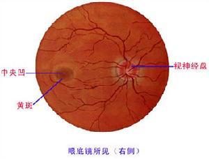 球后视神经炎