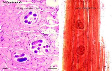 肌肉切片中囊包幼虫
