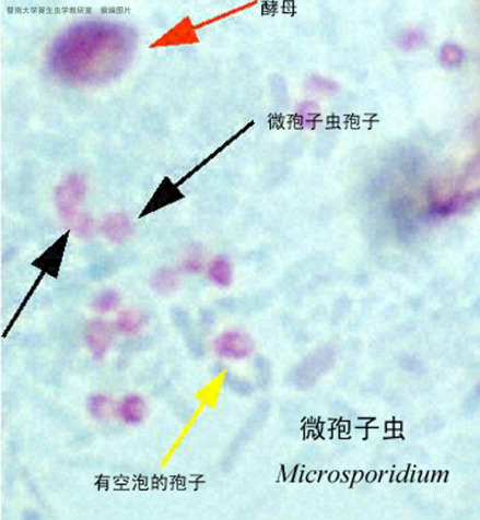 孢子虫