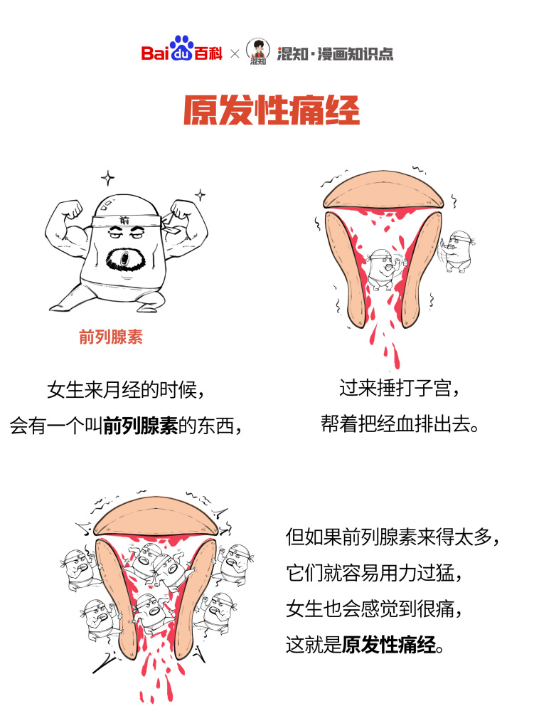 百科x混知：图解原发性痛经