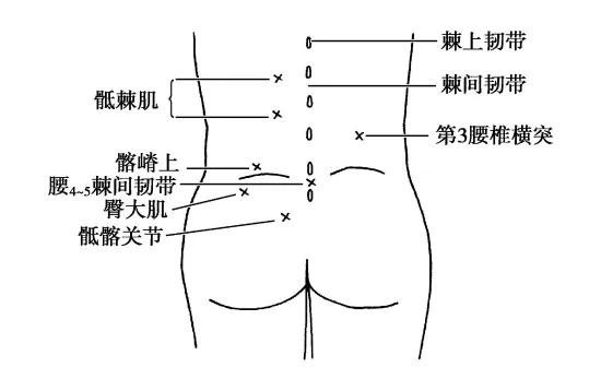 常见压痛点