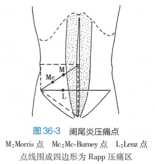 常见压痛点